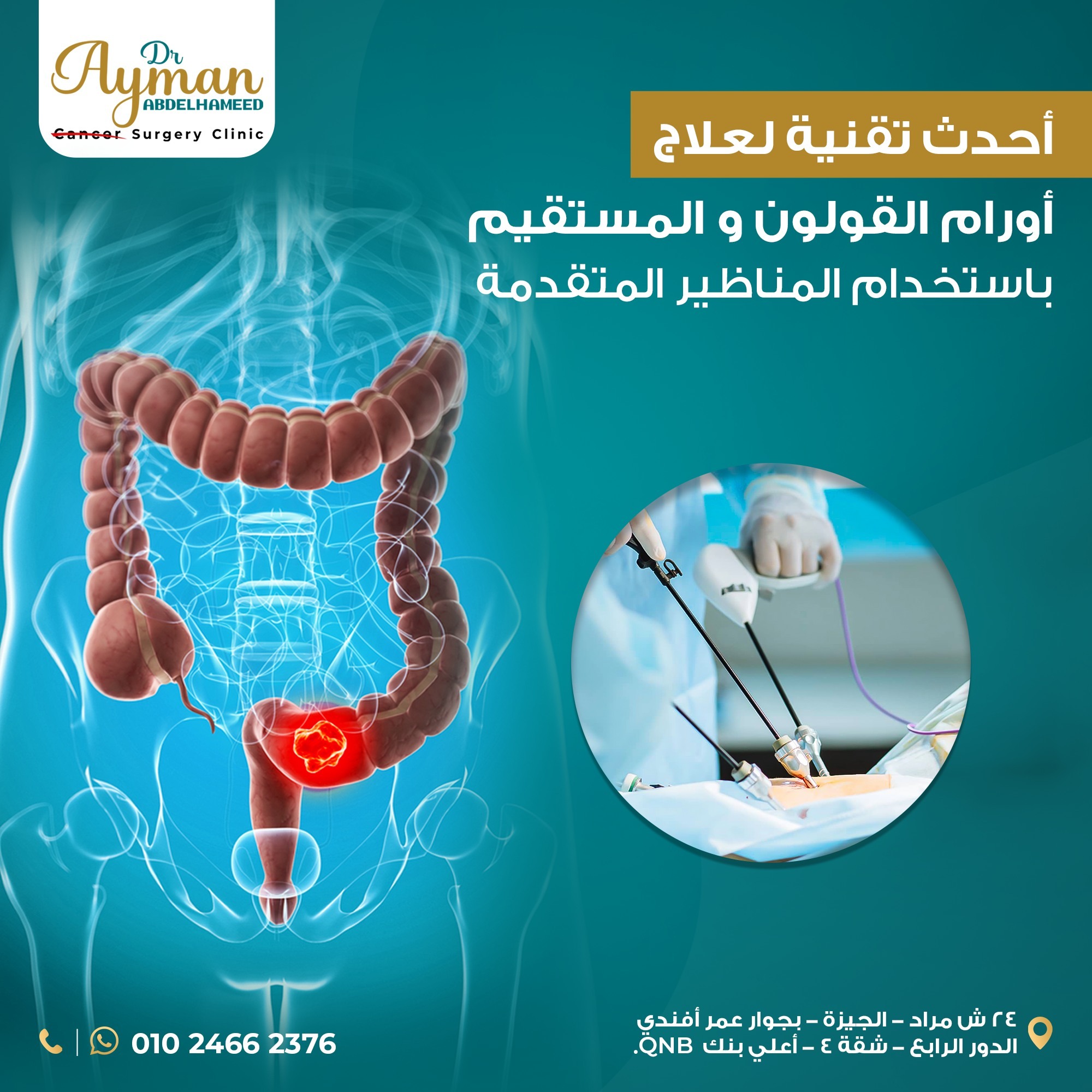You are currently viewing The latest technologies for treating colorectal tumors