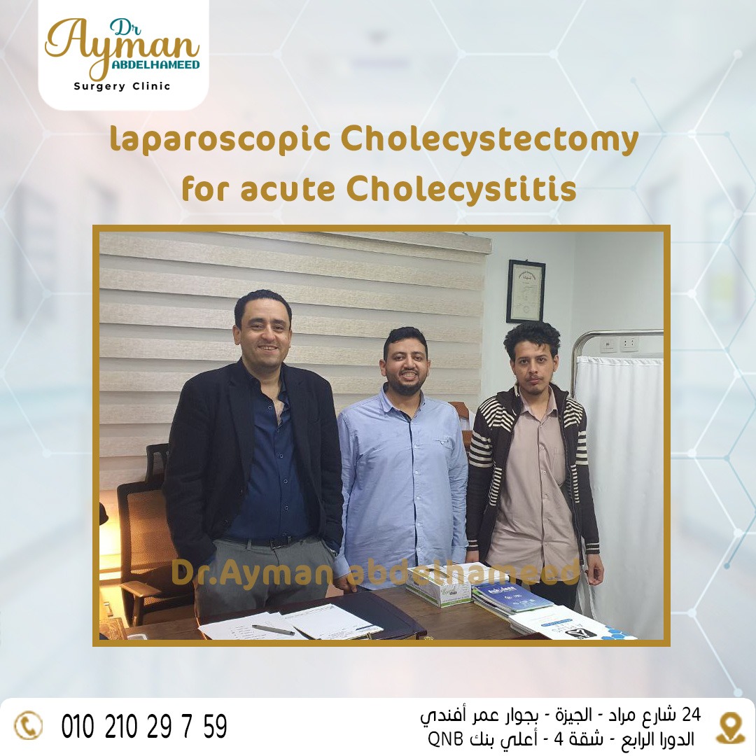 You are currently viewing laparoscopic Cholecystectomy for acute Cholecystitis