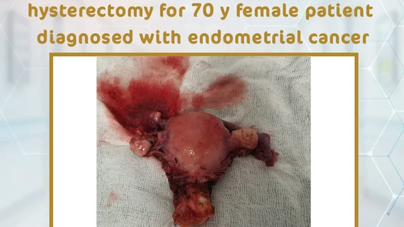 Laparoscopic total abdominal hysterectomy
