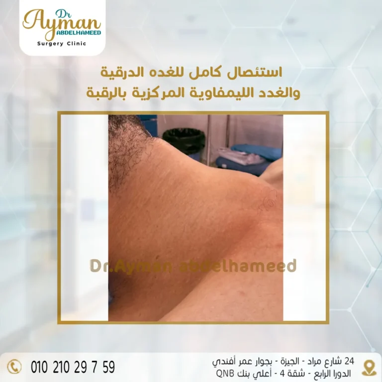 Read more about the article نجاح استئصال كامل للغده الدرقية والغدد الليمفاوية المركزية بالرقبة
