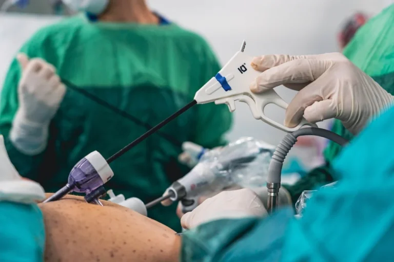 Read more about the article نسبة نجاح عملية استئصال المستقيم بالمنظار