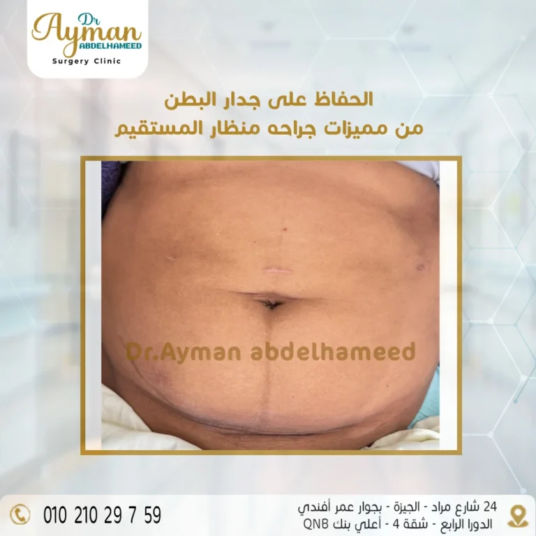 Read more about the article الحفاظ على جدار البطن من مميزات جراحة منظار المستقيم